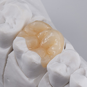 Village Dental of Leesburg | Emergency Treatment, Extractions and Sedation Dentistry