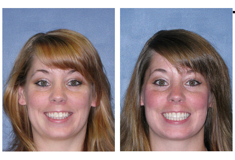 Village Dental of Leesburg