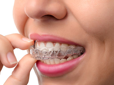Village Dental of Leesburg | Sedation Dentistry, Cosmetic Dentistry and Extractions