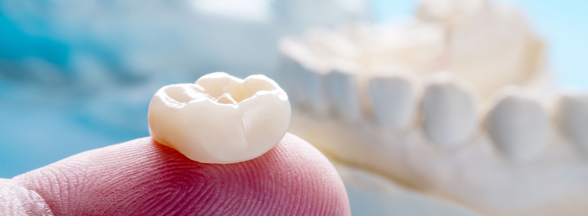Village Dental of Leesburg | Clear Braces, Oral Hygiene and Veneers