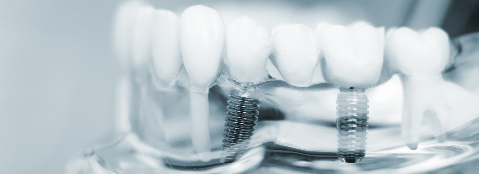Village Dental of Leesburg | Dentures, Teeth Whitening and Crowns
