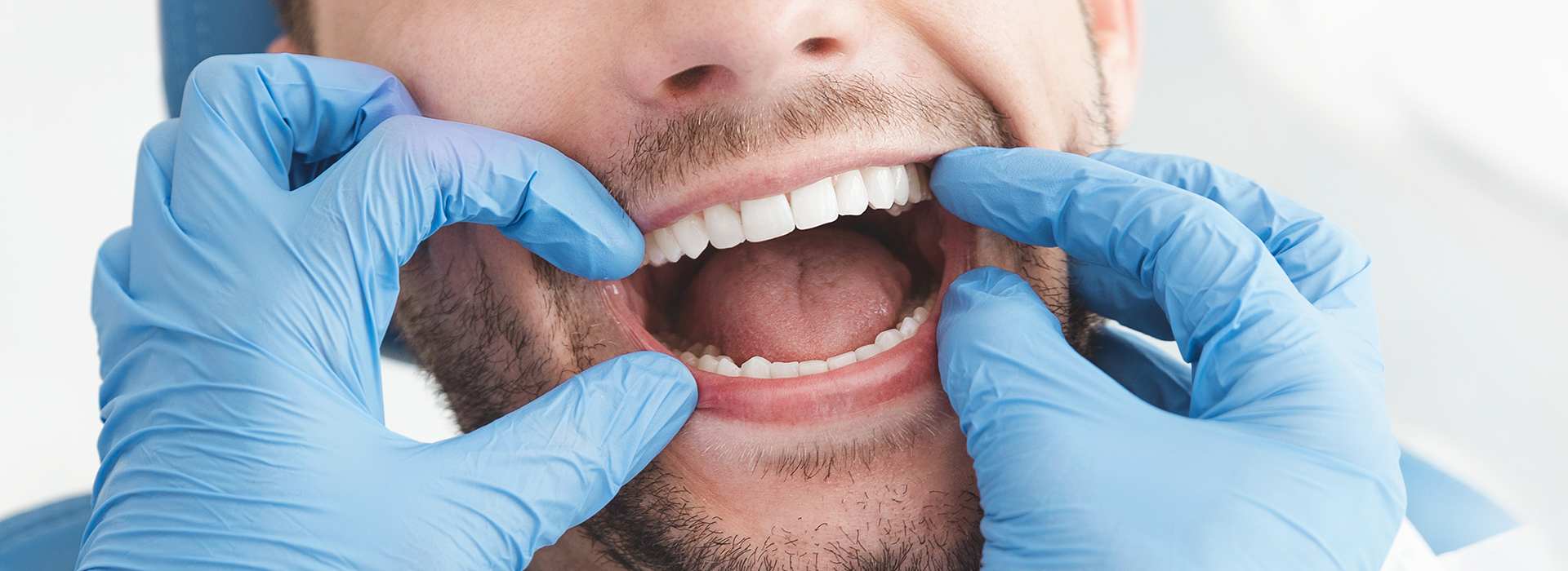 Village Dental of Leesburg | Dental Sealants, Dental Fillings and Arestin