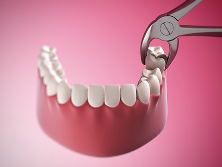 Village Dental of Leesburg | Emergency Treatment, Implant Dentistry and Dental Bonding