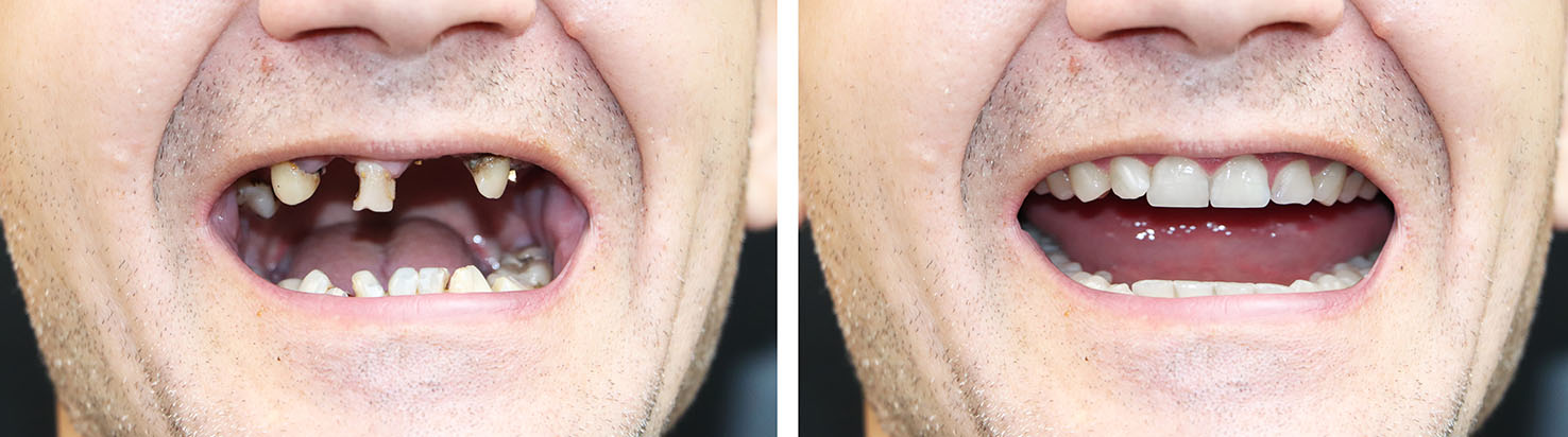 Village Dental of Leesburg | Preventative Program, Non Surgical Root Canal and Clear Braces
