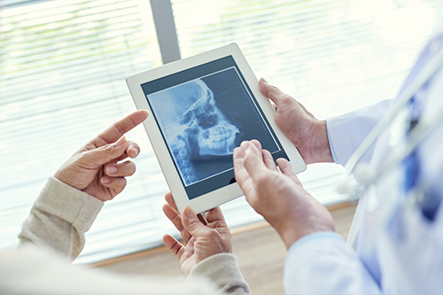 Village Dental of Leesburg | Arestin, Non Surgical Root Canal and Inlays  amp  Onlays