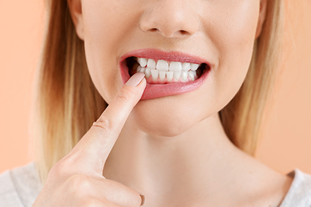 Village Dental of Leesburg | Full Mouth Reconstruction, Dental Bridges and Teeth Whitening