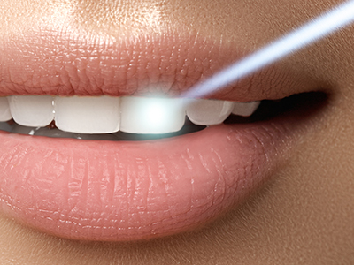 Village Dental of Leesburg | Cosmetic Dentistry, Teeth Whitening and Dental Cleanings