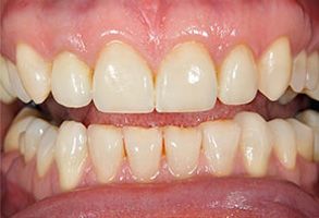 Village Dental of Leesburg | Emergency Treatment, Implant Dentistry and Non Surgical Root Canal