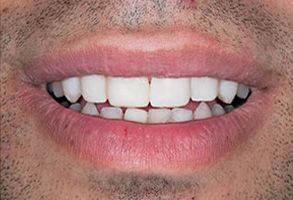 Village Dental of Leesburg | Oral Exams, Dentures and Arestin