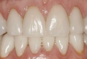 Village Dental of Leesburg | Pediatric Dentistry, ZOOM  Whitening and Oral Hygiene