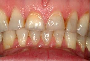 Village Dental of Leesburg | Emergency Treatment, Dental Bridges and Pediatric Dentistry