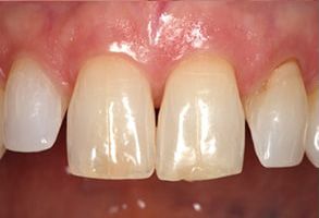 Village Dental of Leesburg | Dental Cleanings, Emergency Treatment and Dental Sealants