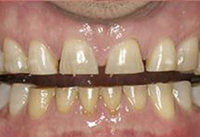 Village Dental of Leesburg | Dental Fillings, Oral Hygiene and Emergency Treatment