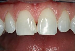 Village Dental of Leesburg | Dentures, Cosmetic Dentistry and Implant Dentistry